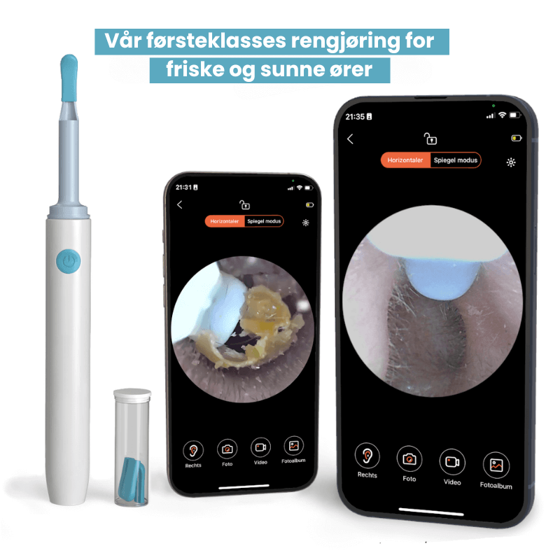 EarScope Pro™ - Smart ørerens med høyoppløselig kamera