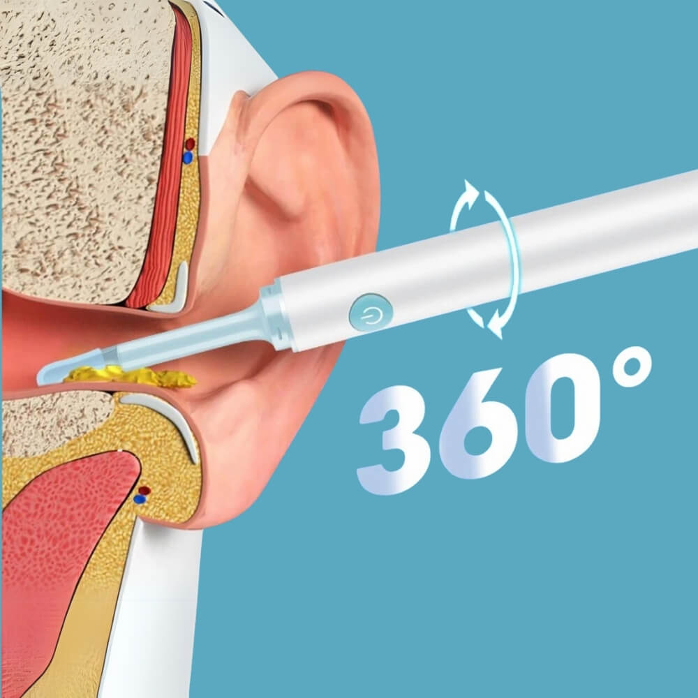 EarScope Pro™ - Smart ørerens med høyoppløselig kamera